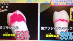 歯ブラシだけではダメ.jpg