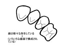 H歯は曲線.jpg