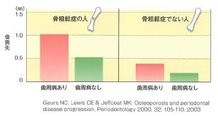 K骨そしょう症 歯周病.jpg