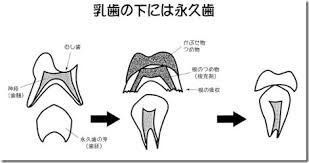 N乳歯の下には永久歯.jpg