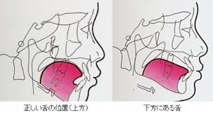Z舌の位置と飲み込み.jpg